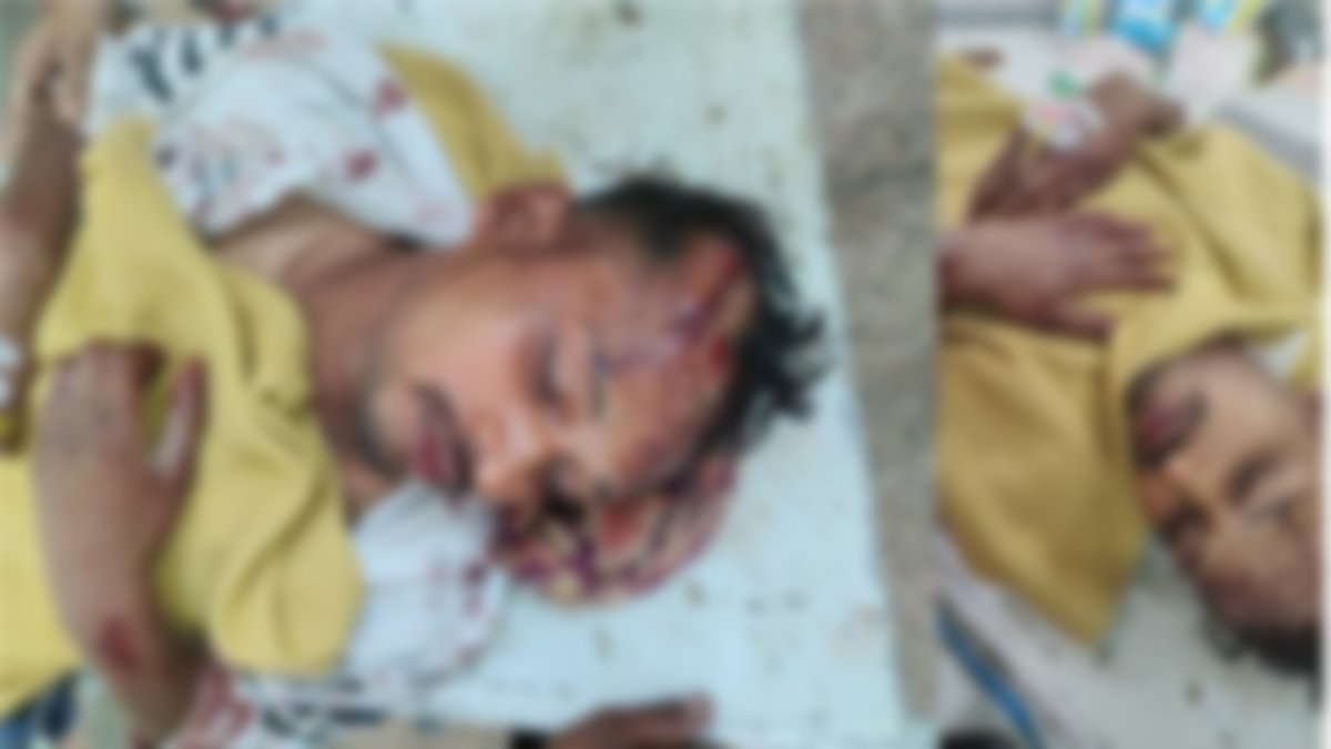 राजधानी में बेखौफ बदमाश: घर में घुसकर युवक पर तलवार से जानलेवा हमला, सिर पर लगे इतने टांके