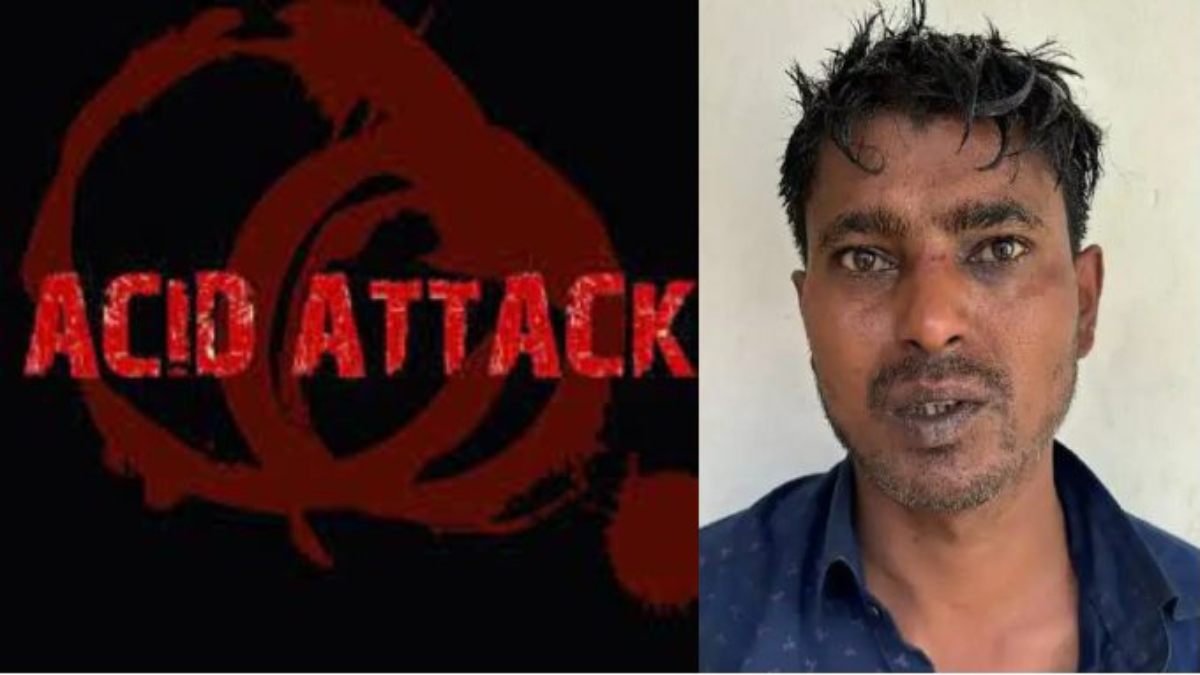 Acid Attack: महिला ग्राहक से दूर बैठने कहा तो युवक ने फेंकी एसिड, दुकानदार के पीठ और पैर जले