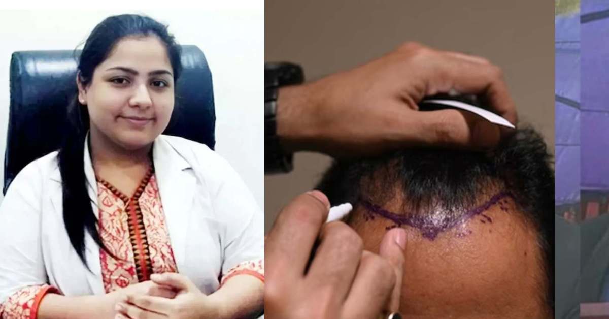 कहां है ‘कातिल’ डॉक्टर! हेयर ट्रांसप्लांट सर्जरी के बाद 2 लोगों की गई जान, अनुष्का तिवारी के बारे में पुलिस ने किया चौंकाने वाला खुलासा