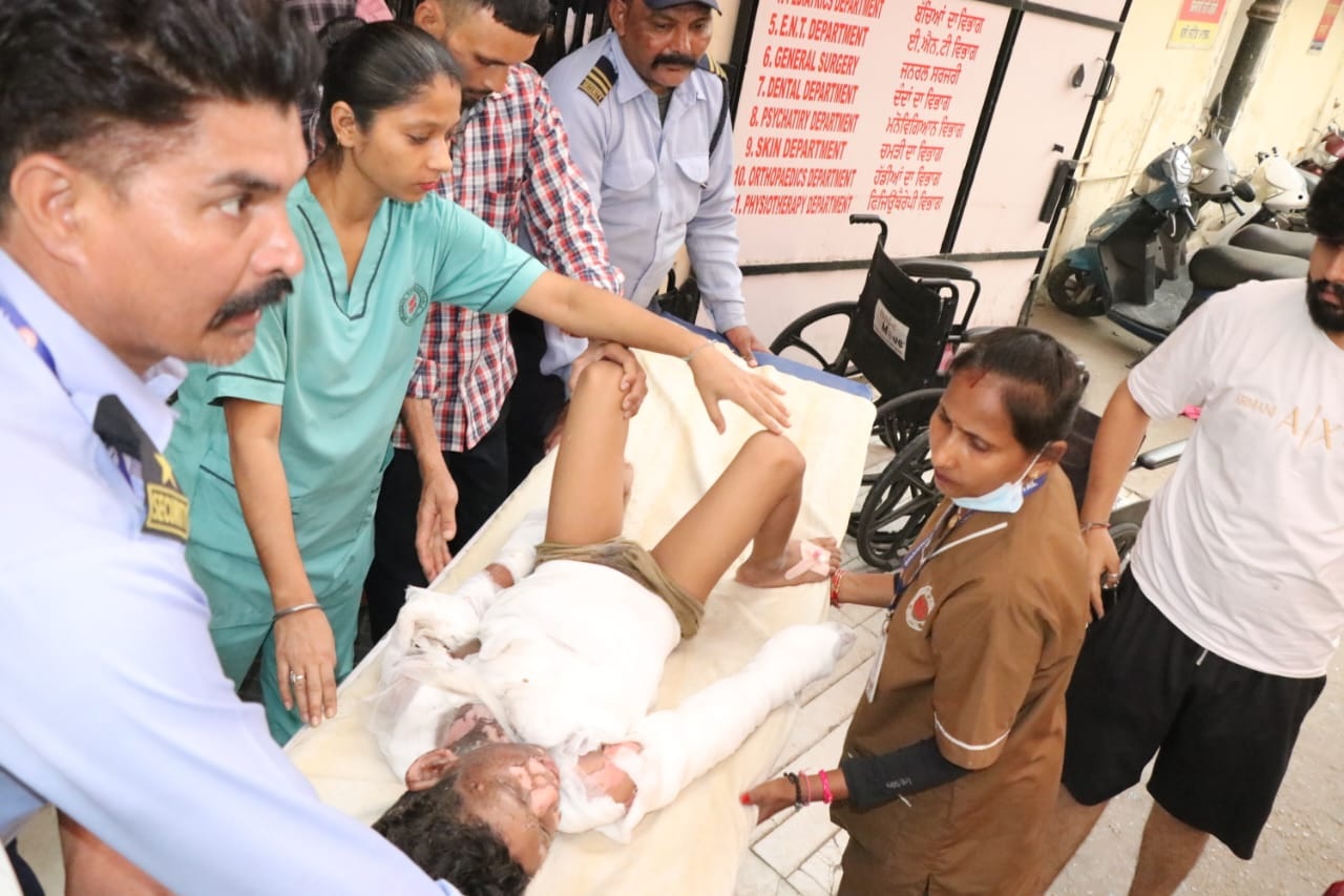 हाई टेंशन तार की चपेट में आया मासूम, बच्चे की हालत नाजुक