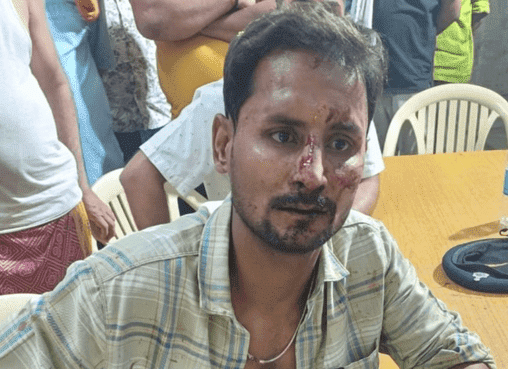 Bihar News: अधिवक्ता पर जानलेवा हमला, पार्किंग विवाद में मारपीट और फायरिंग, 10 लोगों पर केस दर्ज