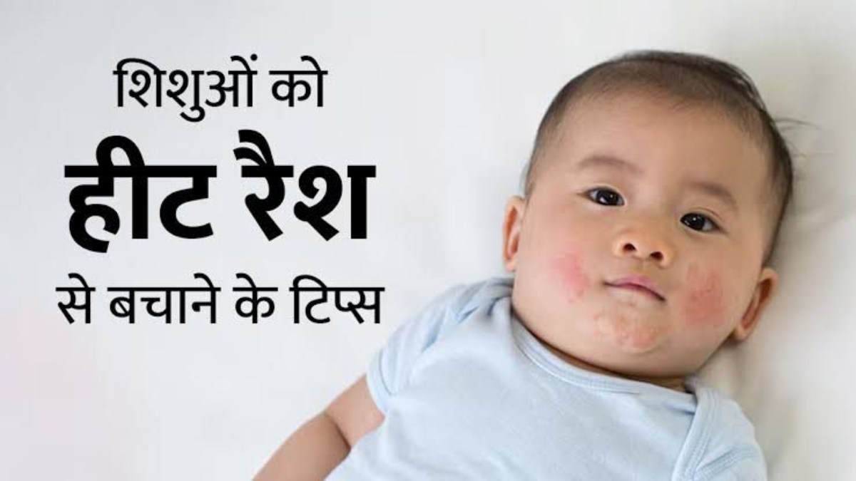 गर्मी में छोटे बच्चों को हो जाता है रैशेज, तो ऐसे करें उनकी देखभाल …