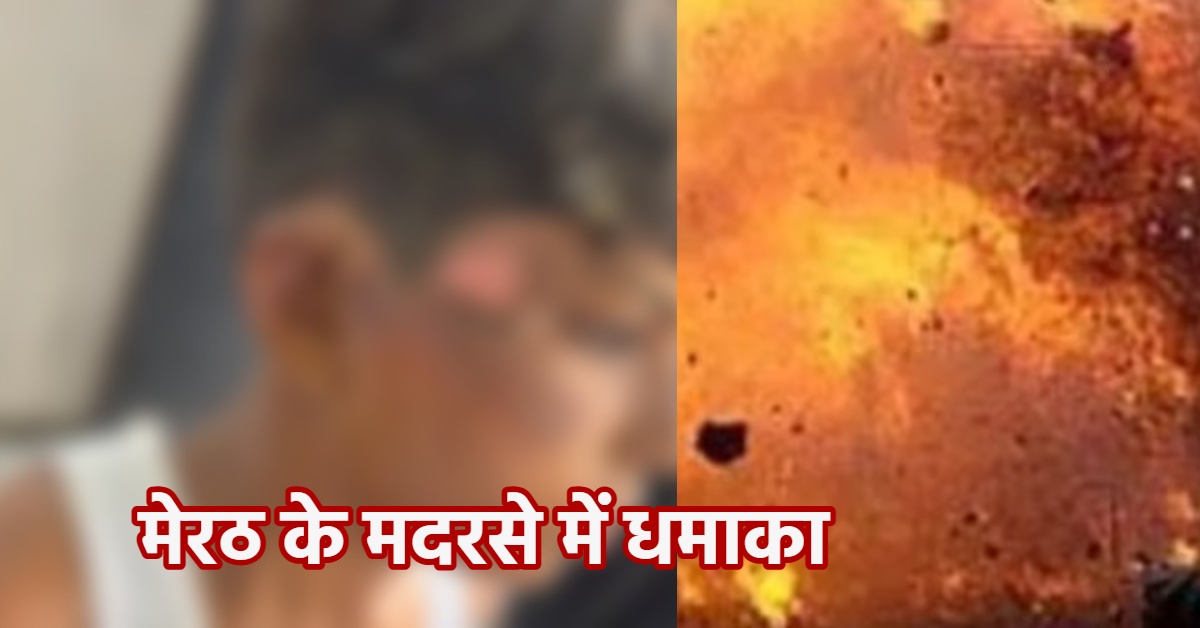 मदरसे में इन्वर्टर फटने से धमाका : एक दर्जन छात्र झुलसे, तीन की हालत गंभीर