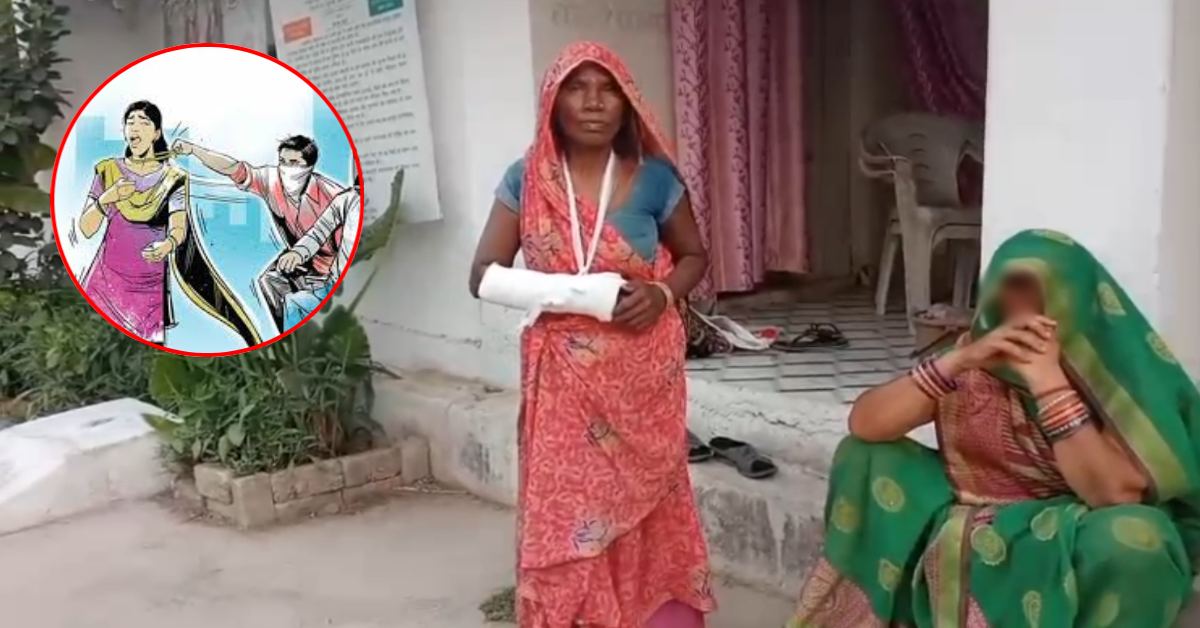 मंगलसूत्र छीनकर भागे नकाबपोश बदमाश: धक्का लगने से महिला का टूटा हाथ, मैहर में सक्रिय हुए चेन स्नेचर