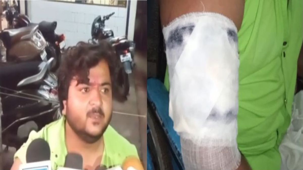 बेटे ने मांगा अपना हक तो पिता ने मार दी गोली: दूसरी पत्नी के साथ मिलकर किया जानलेवा हमला