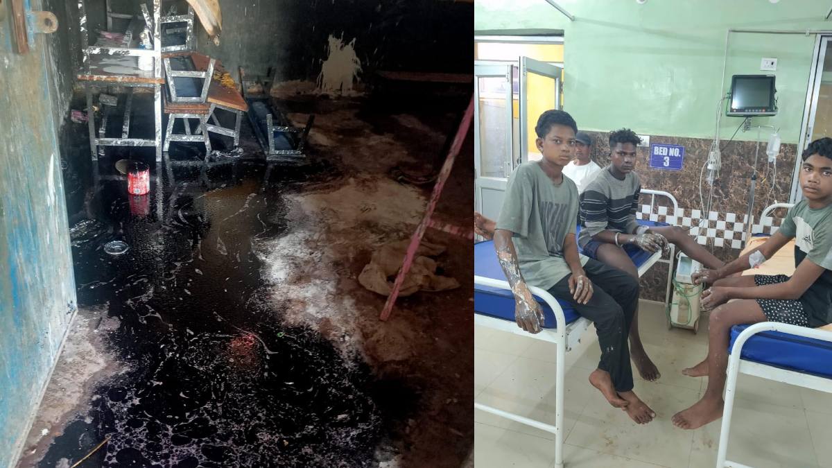 स्कूल में पेंटिंग के दौरान लगी आग, नाबालिग समेत 5 मजदूर झुलसे, बाल श्रम को लेकर शिक्षा विभाग पर उठे सवाल..