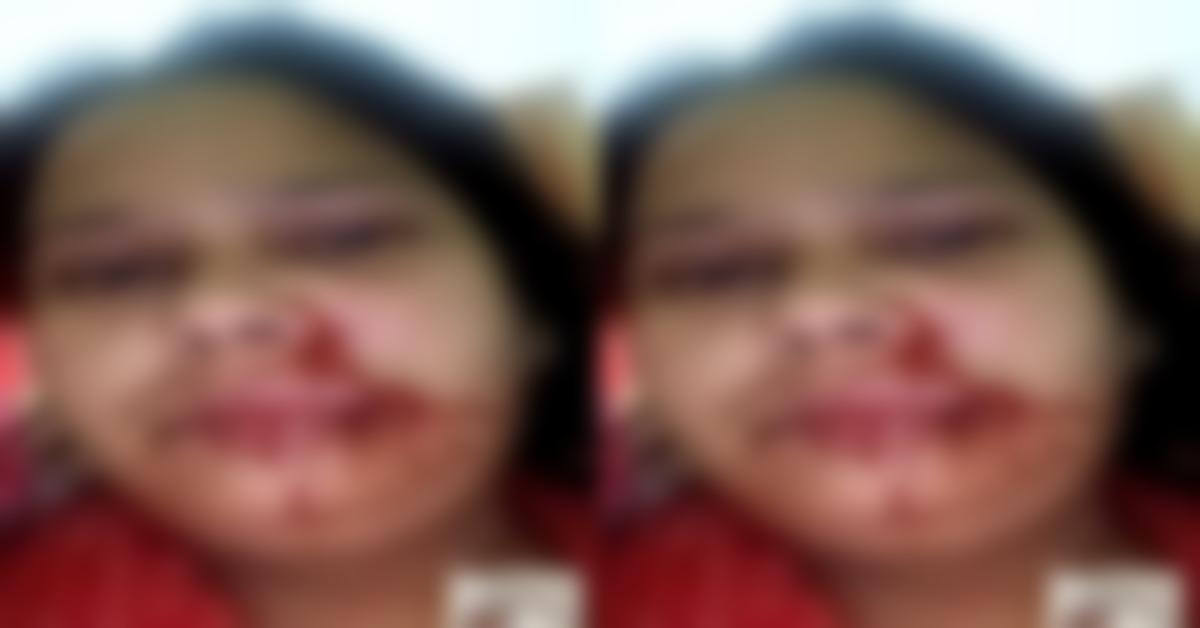 ‘सीमा’ पर सितम: बहू को ससुराल वालों ने बनाया बंधक, देवर और ससुर ने डंडों से पीटा