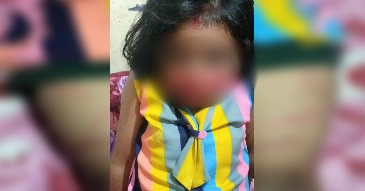 बाथरूम में बंदकर डंडे से पीटा-बाल काटे और मांग में लगाया सिंदूर: 5 साल की बच्ची से बर्बरता, काजल-लिपस्टिक से छिपाए चोट के निशान, तंत्र मंत्र की आशंका