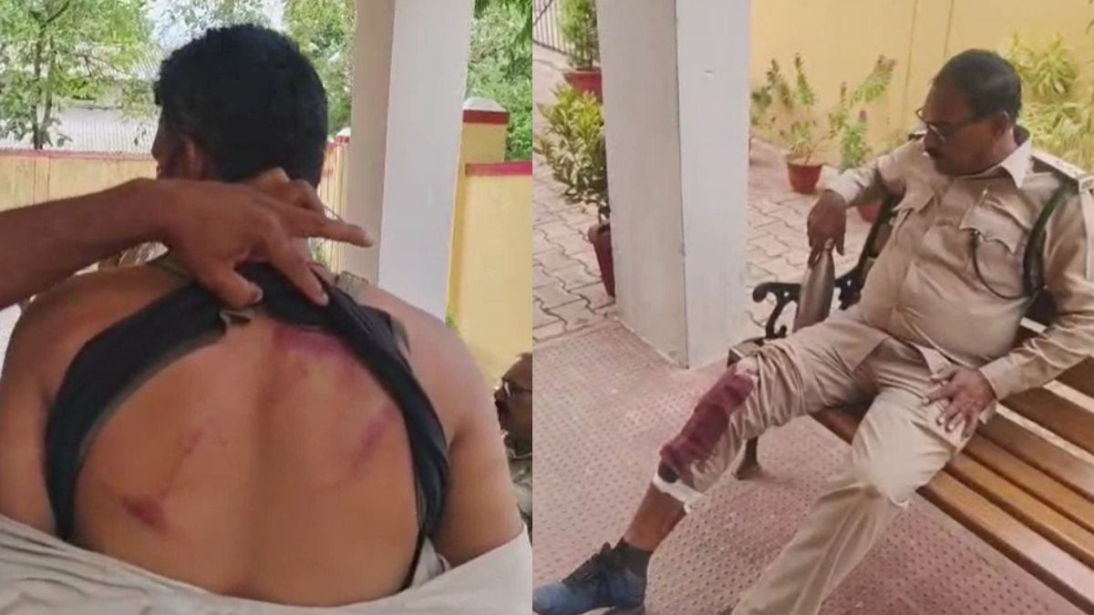CG News : निरीक्षण करने पहुंची वन विभाग की टीम पर लाठी-डंडे से हमला, डिप्टी रेंजर समेत 4 घायल