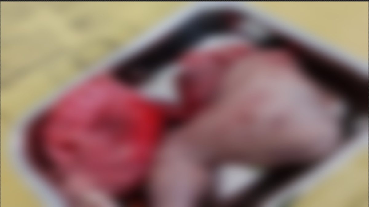 कलयुगी मां की घिनौनी करतूत: नवजात को अस्पताल के टॉयलेट में जन्म देकर भागी, कुत्तों ने नोंच खाया शरीर का आधा हिस्सा