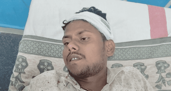 Bihar News: रास्ता विवाद को लेकर हुई जमकर मारपीट, 20 हजार रुपए भी छीना