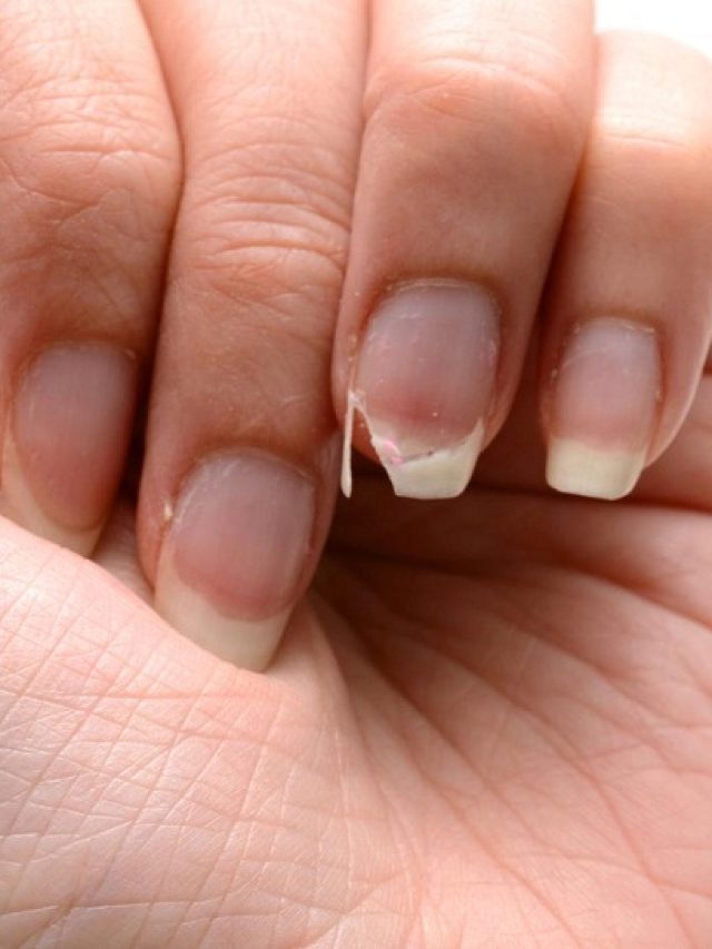 Nail Breaking Astrology Reason: नाखूनों का बार-बार टूटना, देते है ये संकेत…