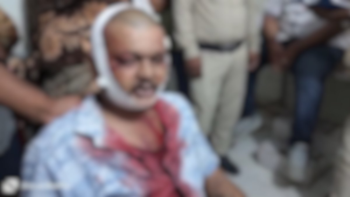 मुस्लिम युवकों का आतंकः घर में घुसकर बरसाए लाठी डंडे, बीच बचाव करने आए पड़ोसी को भी पीटा, मारपीट की घटना सीसीटीवी कैमरे में कैद, 4 के खिलाफ FIR