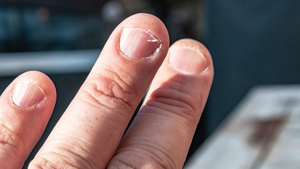 Nail Breaking Astrology Reason