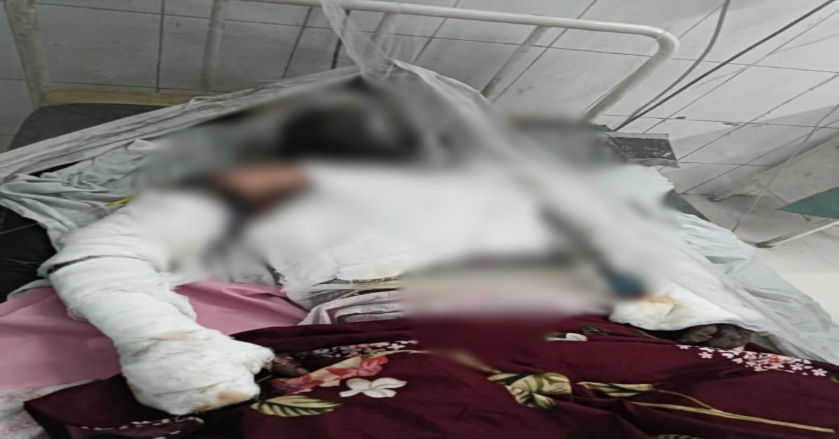 प्रेमी ने की सुसाइड की कोशिश: प्रेमिका के घर के सामने लगाई आग, गंभीर हालत, शादी का झांसा देकर पैसे ऐंठने का आरोप