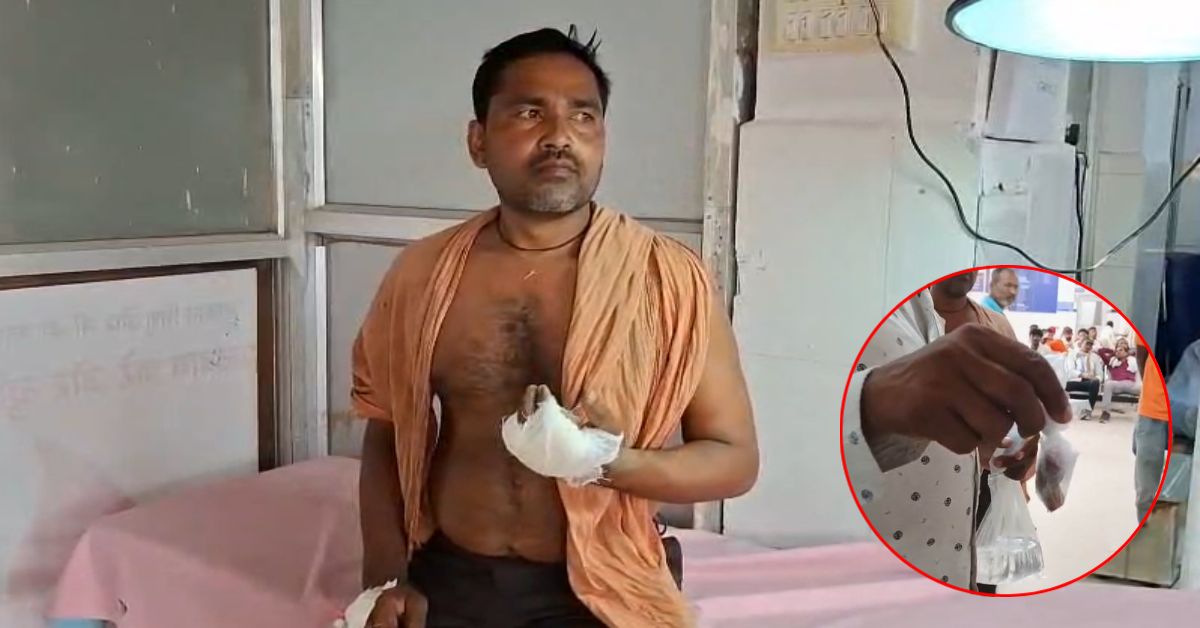 इसे कहते हैं खौफ? सांप के डसने के बाद शख्स ने खुद ही काट ली उंगली, फिर पहुंंचा अस्पताल…