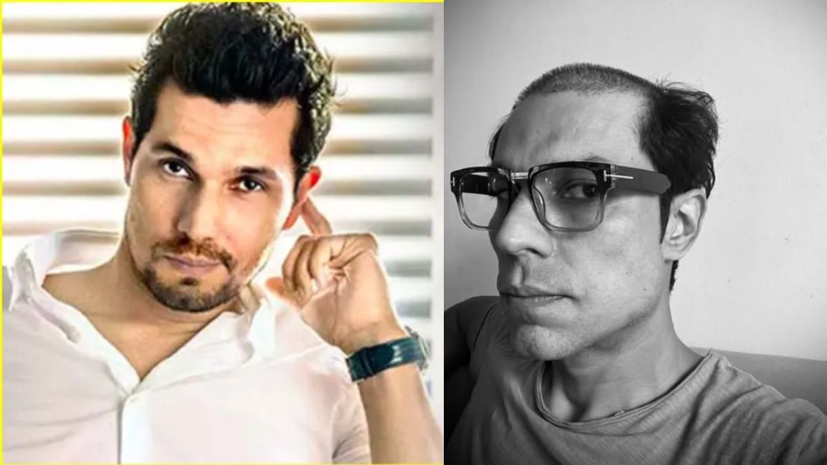 Randeep Hooda के सिर से उड़े आधे बाल, ये लुक देखकर फैंस हुए हैरान …