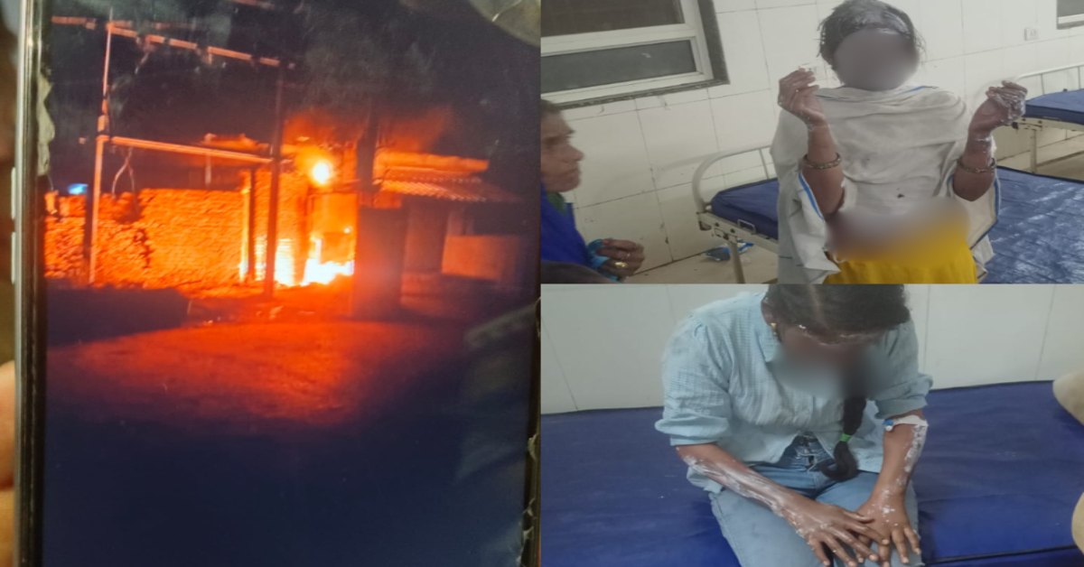 विद्युत ट्रांसफार्मर में ब्लास्ट के बाद लगी आग: घर पर सो रही मां-बेटी गर्म तेल निकलने से झुलसी, अस्पताल में इलाज जारी