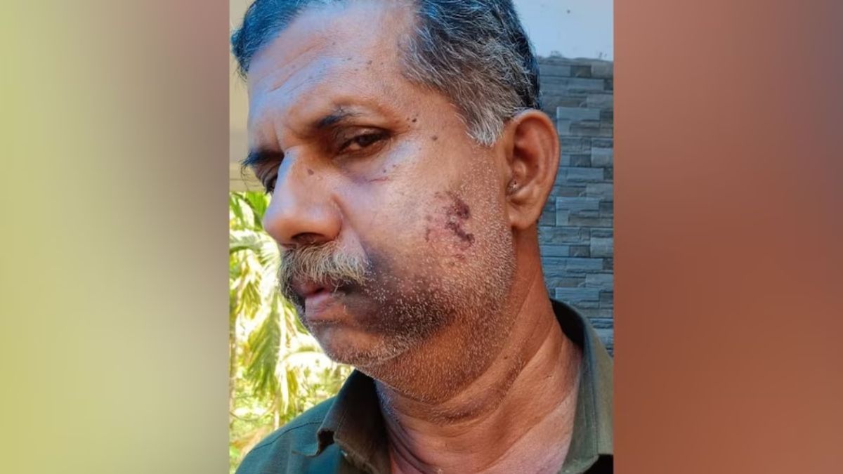 अजीबोगरीब मामला: चौथी क्लास में हुआ था झगड़ा, 50 साल बाद बदला लेते हुए दो दोस्तों ने मिलकर साथी का तोड़ दिया दांत