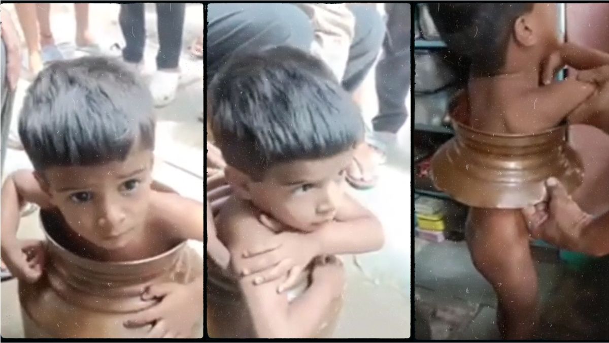 गागर में फंसा 2 साल का मासूम: बर्तन काटकर निकाला बाहर, Video Viral