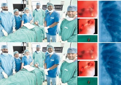 Raipur Aiims News: 13 साल के बच्चे की श्वांस नली में फंसी पिन एम्स में निकाली गई