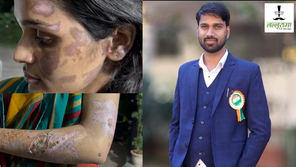 CG News : हैवान पति! पत्नी को मारने गर्म पानी में डुबोया चेहरा, गर्म चिमते से चिमटा… आरोपी चलाता है Academy