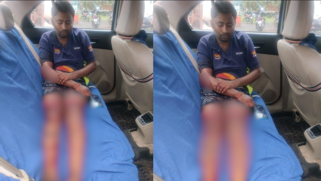 CG Crime News : चॉइस सेंटर संचालक पर चाकू से जानलेवा हमला, आरोपियों ने पुरानी रंजिश में वारदात को दिया अंजाम