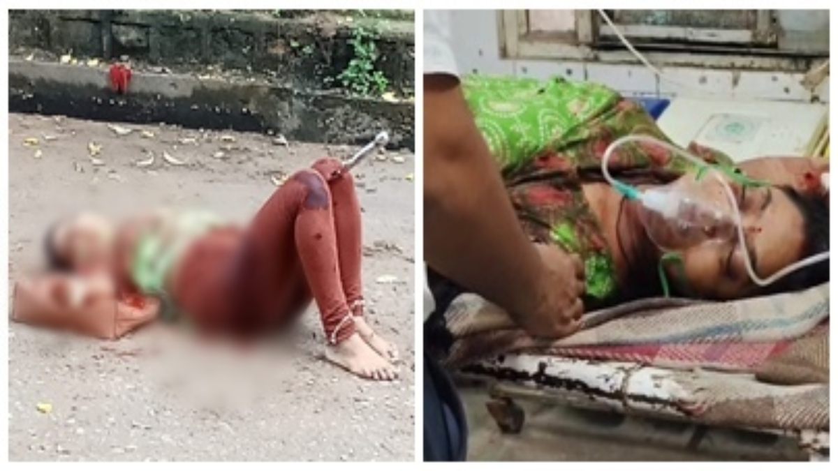 सड़क पर पति का खूनी खेल: पत्नी पर किए कई वार, जांघ में फंस गई तलवार, वजह जान आप भी रह जाएंगे हैरान 