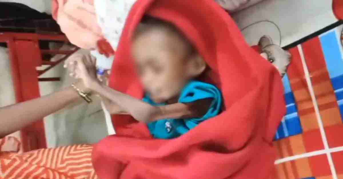 कमला राजा अस्पताल से अति कुपोषित बच्ची लापता! आईसीयू में थी भर्ती, माता-पिता पर बिना बताए ले जाने का आरोप