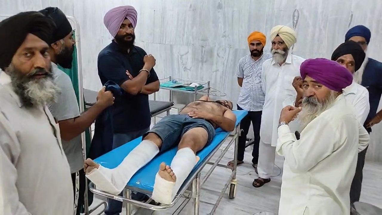 नवांशहर में साले ने बदमाशों के साथ मिलकर जीजा पर किया हमला, पैर तोड़ा