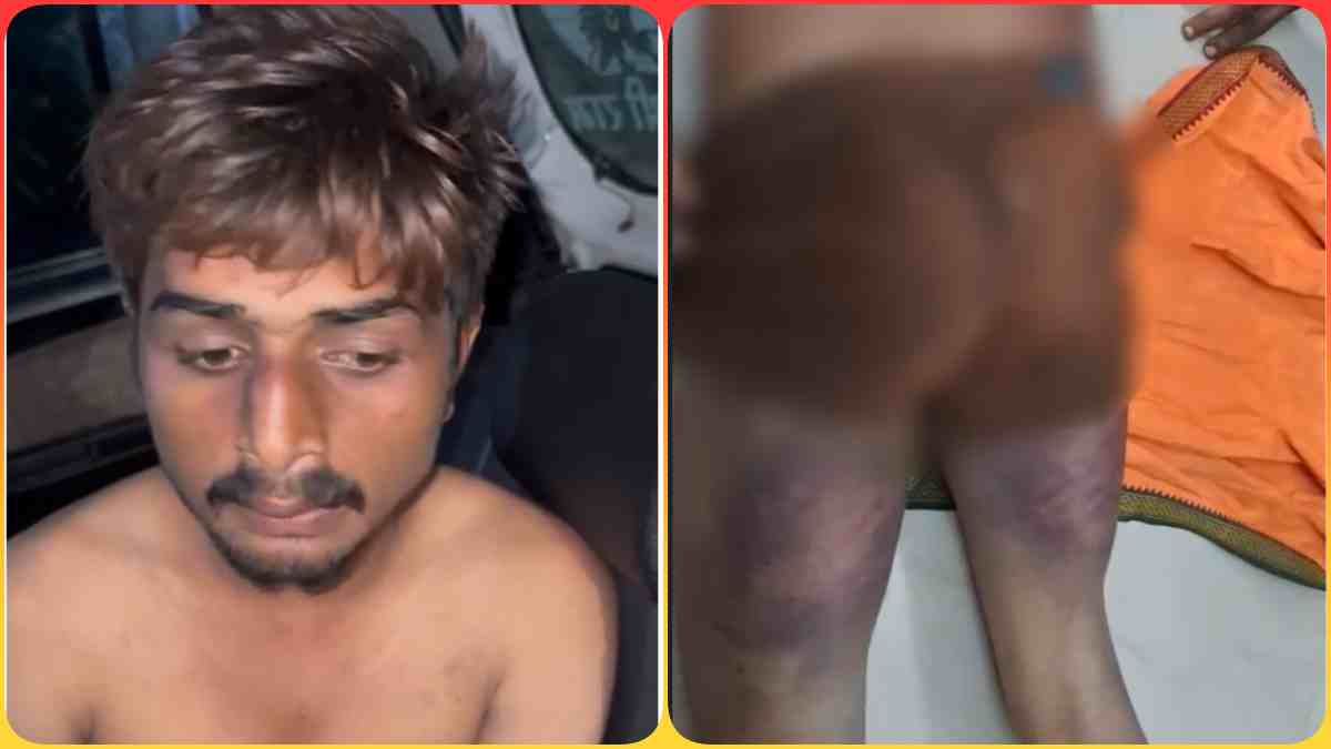 ‘सैलरी मांगने पर मिली गालियां’, विधायक अभय मिश्रा पर   स्टाफ ने लगाए मारपीट के आरोप, कहा- खुद 30 लाठियां मारी, गुर्गों से पिटवाया