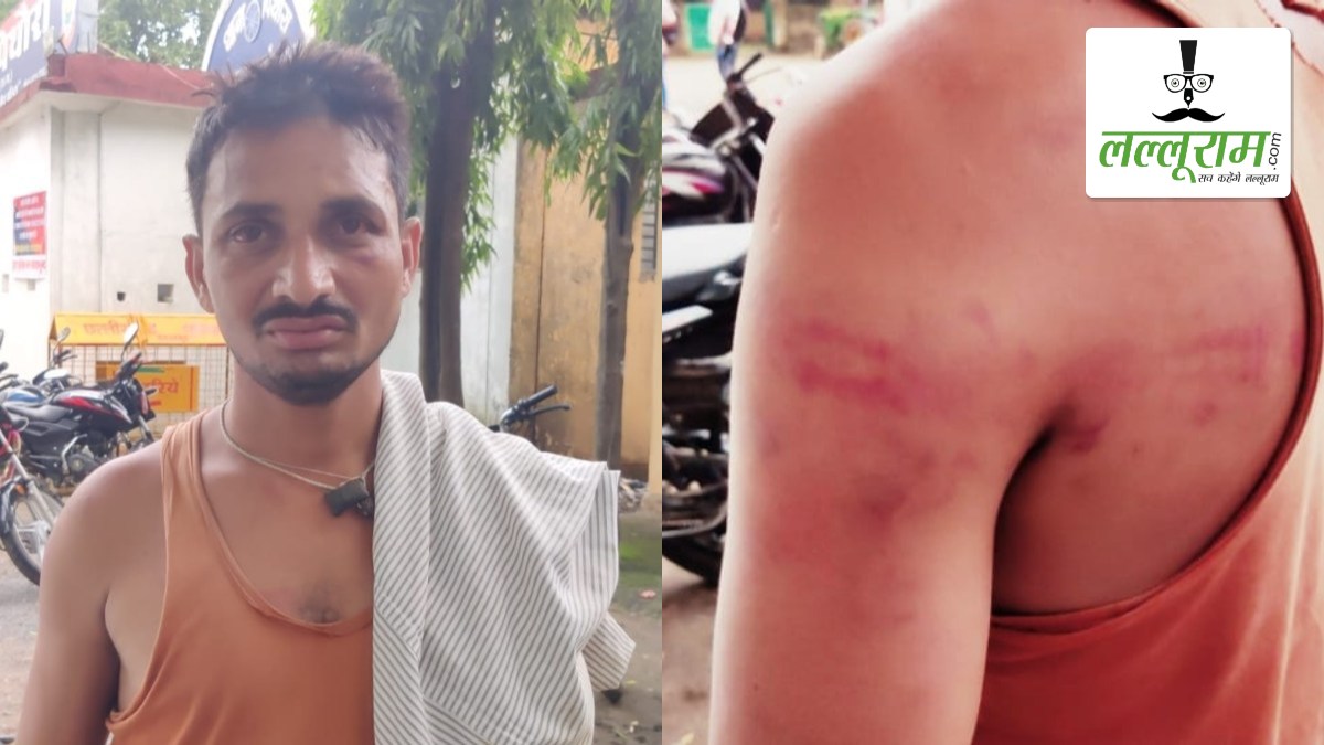 लोन की किश्त नहीं भरने पर युवक का अपहरण: बजाज फाइनेंस कंपनी के एजेंट ने साथियों के साथ मिलकर रातभर पीटा, 6 के खिलाफ मामला दर्ज