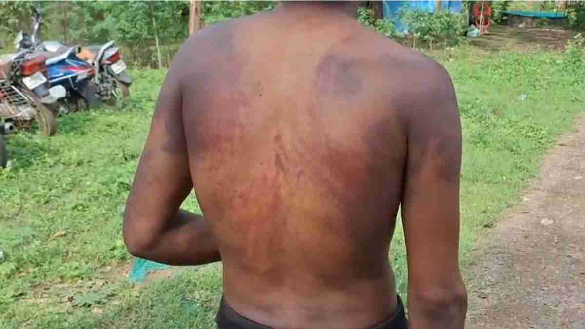 MP में वन रक्षक की दबंगई: आदिवासी को बेरहमी से पीटा, शरीर पर निशान बने, FIR दर्ज