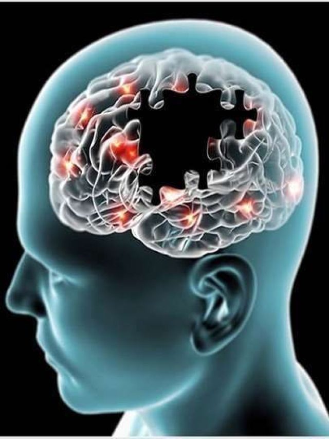 Alzheimer’s Disease: किन लोगों को अल्जाइमर का खतरा ज्यादा होता है?