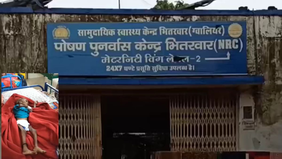 कुपोषण का दंशः ग्वालियर में बीते 3 महीने में 136 कुपोषित और अतिकुपोषित बच्चे NRC में भर्ती, पोषण आहार योजना पर उठे सवाल