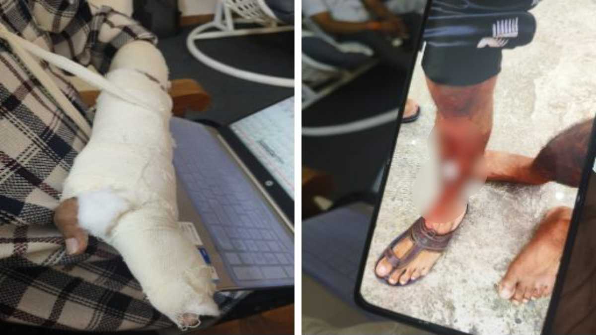 मां को गालियां देने पर जताया विरोधः पड़ोसी ने बीटेक के छात्र को डंडों से जमकर पीटा, वीडियो वायरल