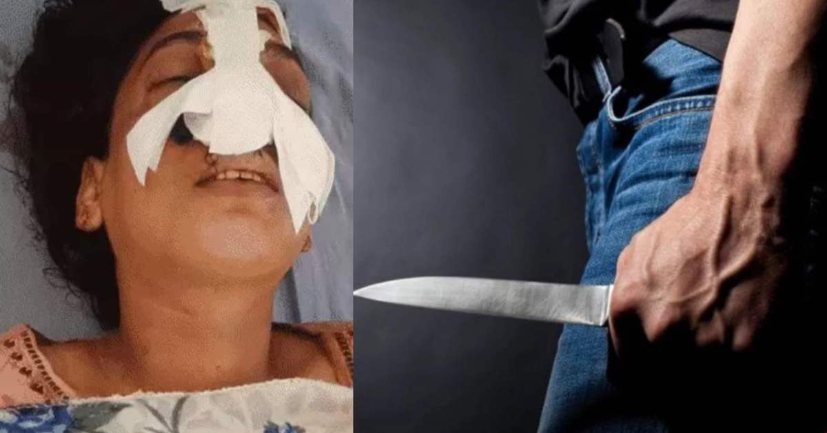 शौहर बना शैतानः पत्नी ने नहीं मानी पति की बात, गुस्से में चाकू से काट दी नाक, पूरा मामला जानकर रह जाएंगे हैरान