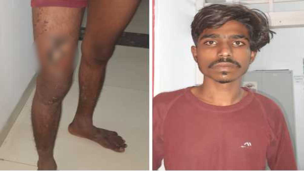 जंगल में दरिंदगी और करंटः नाबालिग को किडनैप कर दुराचार करने वाला आरोपी करेंट की चपेट में आया