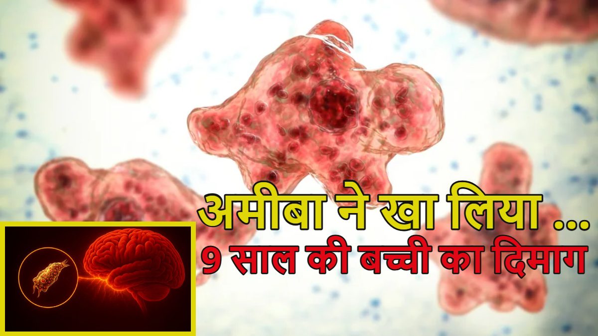 बच्ची का दिमाग अमीबा ने खा लियाः ‘ब्रेन-ईटिंग अमीबा’ से 9 साल की बच्ची की मौत, सरकार-स्वास्थ्य विभाग के फूले हाथ-पैर, जानिए इस घातक बीमारी के बारे में