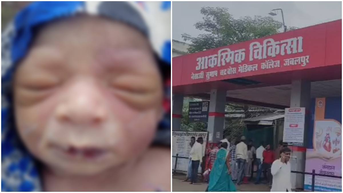 लापरवाही की भी हद है… जबलपुर मेडिकल कॉलेज में नवजात के शवों की अदला-बदली, लड़की की जगह थमा दिया लड़का, परिजनों का हंगामा, जांच के आदेश  