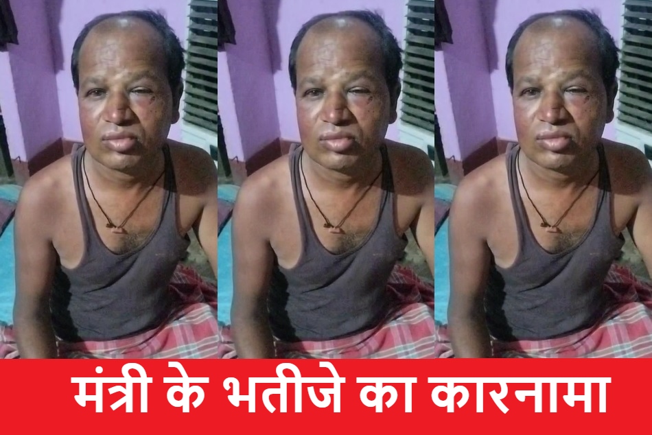 ‘मेरे चाचा छत्तीसगढ़ के मंत्री हैं’… भतीजे ने पेट्रोल पंप के सुपरवाइजर के साथ की मारपीट, कांग्रेस का आरोप पुलिस ने दर्ज नहीं किया लूट का मामला