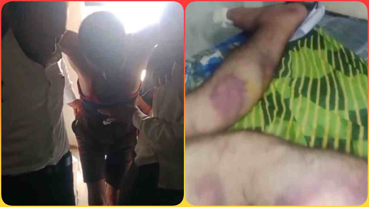‘पुलिस कस्टडी में दलितों को दिया थर्ड डिग्री टॉर्चर’, कांग्रेस ने लगाए गंभीर आरोप, कहा- नाखून तक तोड़ दिए, DGP से पुलिसकर्मियों को सस्पेंड करने की मांग