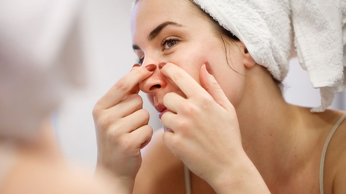 Skin Care Tips: कहीं आप भी तो नहीं करते पिंपल फोड़ने की गलती, हो सकता है इंफेक्शन का खतरा