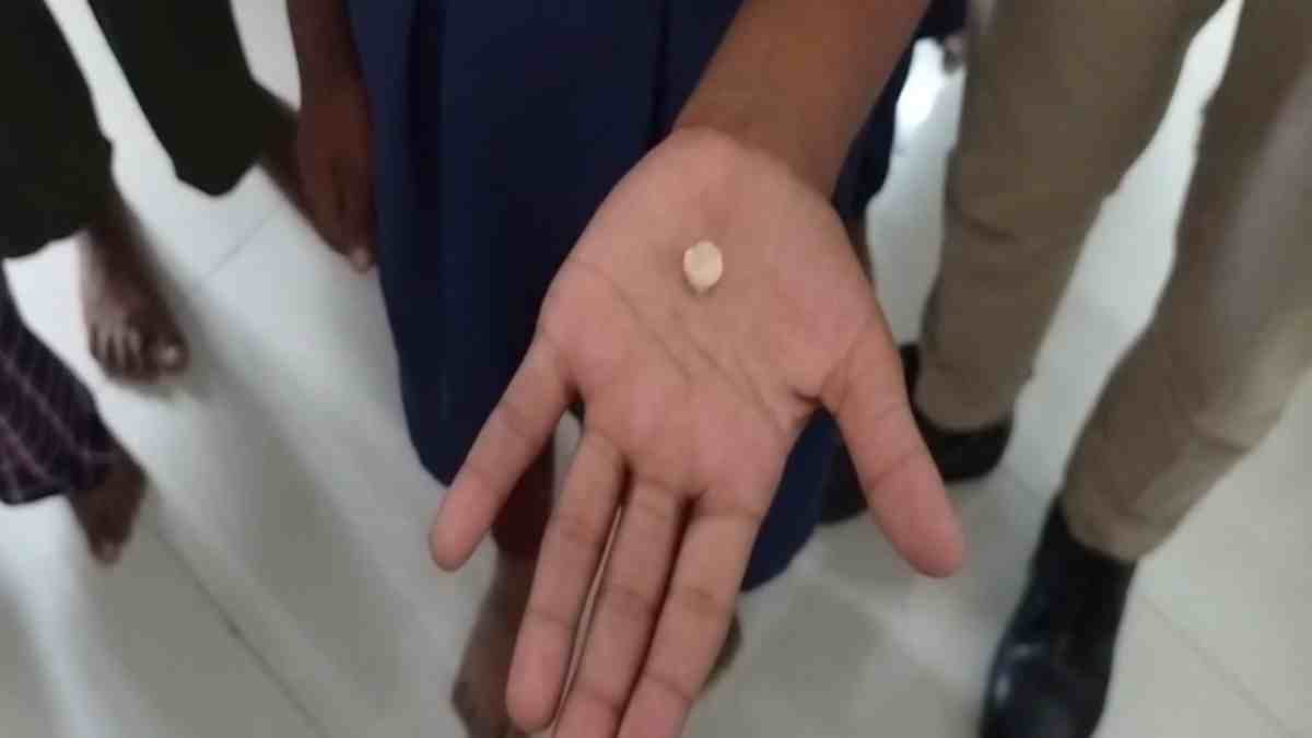 हैवान प्रिंसिपल: ऐसा पीटा कि छात्रा का टूट गया दांत, बच्चे बोले- बेहोश होने तक मारते हैं, हाथ-पैर भी दबवाते हैं