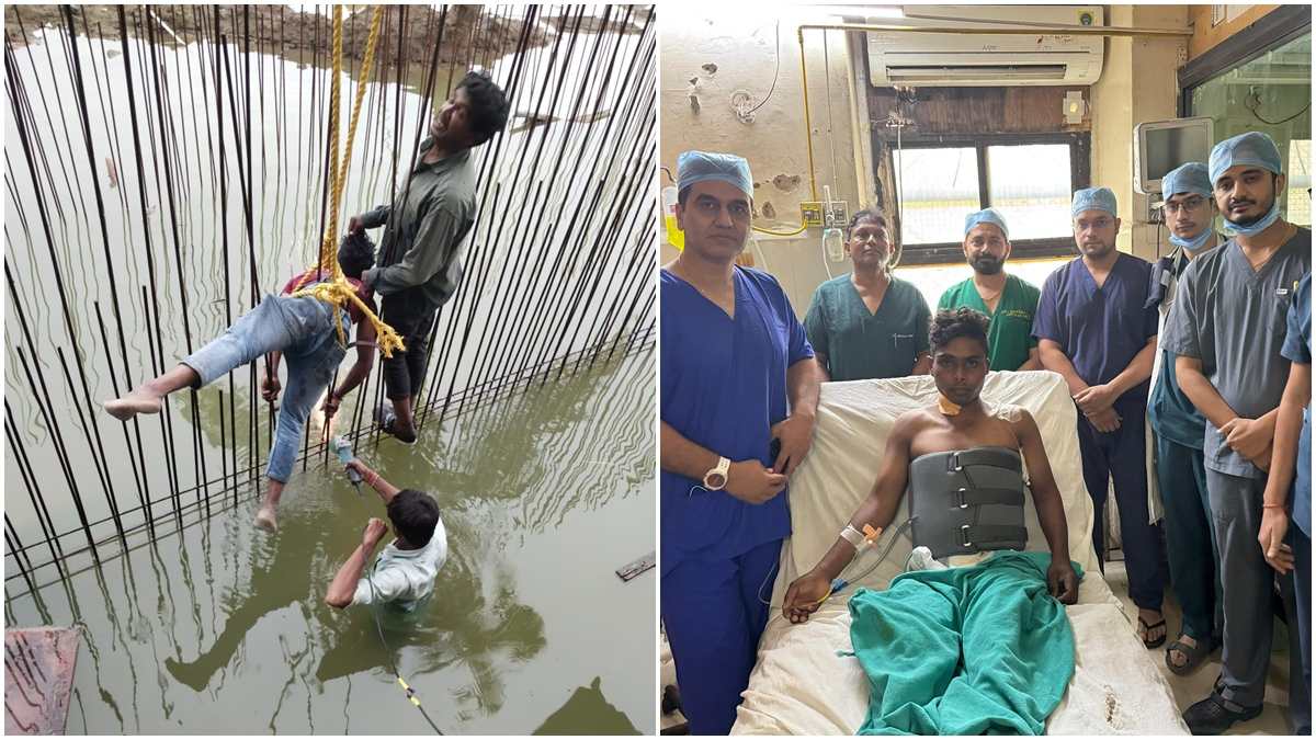 इंदौर एमवाय अस्पताल के डॉक्टरों ने किया कमाल: मजदूर के शरीर से तीन सरिए निकालकर बचाई जान, 5 घंटे चले ऑपरेशन के बाद युवक को मिली नई जिंदगी    