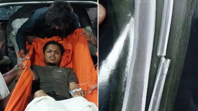 Rajasthan News: विधायक को वादा याद दिलाना पड़ा भारी, पानी मांगने वाले युवक के दोनों पैर तोड़े