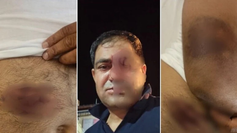 Rajasthan News: जोधपुर में पुलिसकर्मियों पर कुल्हाड़ी-डंडों से हमला, चार आरोपी गिरफ्तार