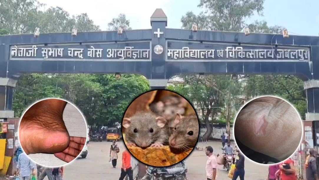 सरकारी अस्पतालों में नहीं थम रहा चूहों का आतंक: इंदौर के बाद जबलपुर मेडिकल कॉलेज में मरीजों को काटा, पैर और ऐड़ी को कुतरा