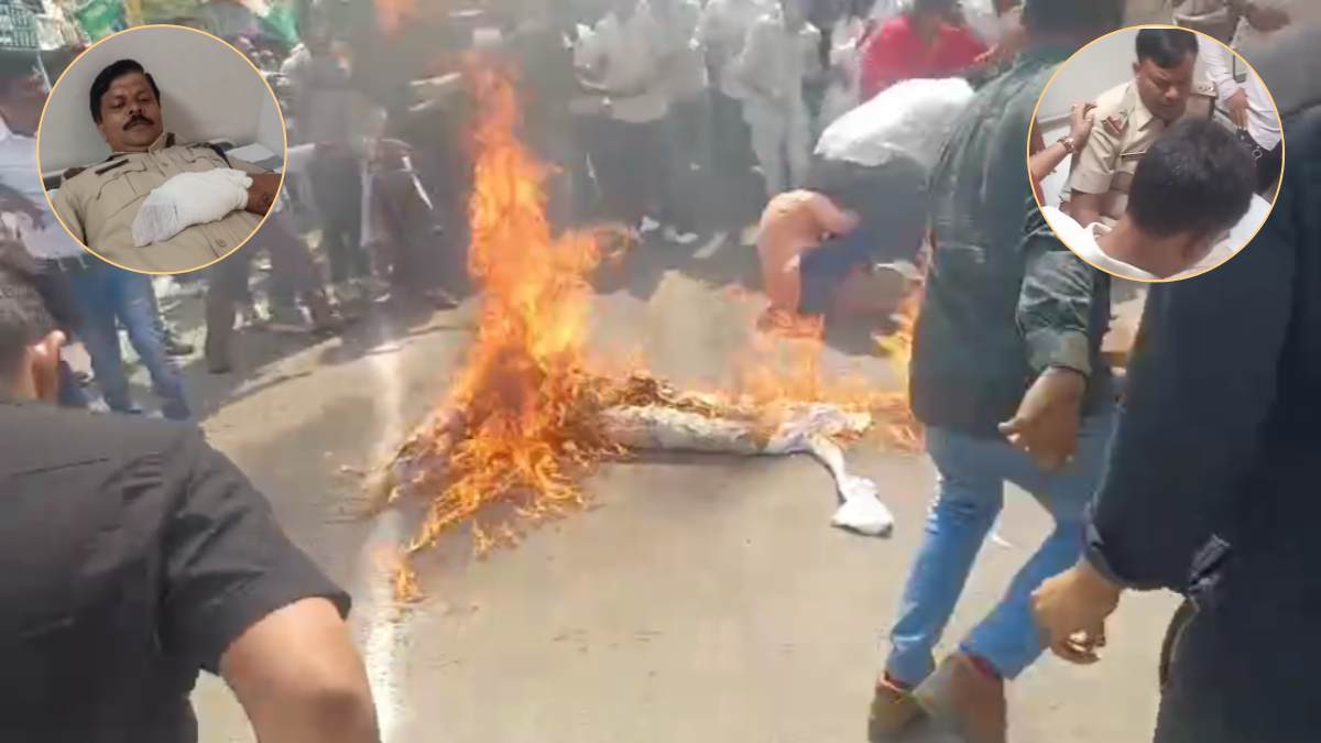 कांग्रेस के पुतला दहन में अचानक भड़की आग, SI समेत 3 पुलिसकर्मी बुरी तरह झुलसे, अस्पताल में भर्ती