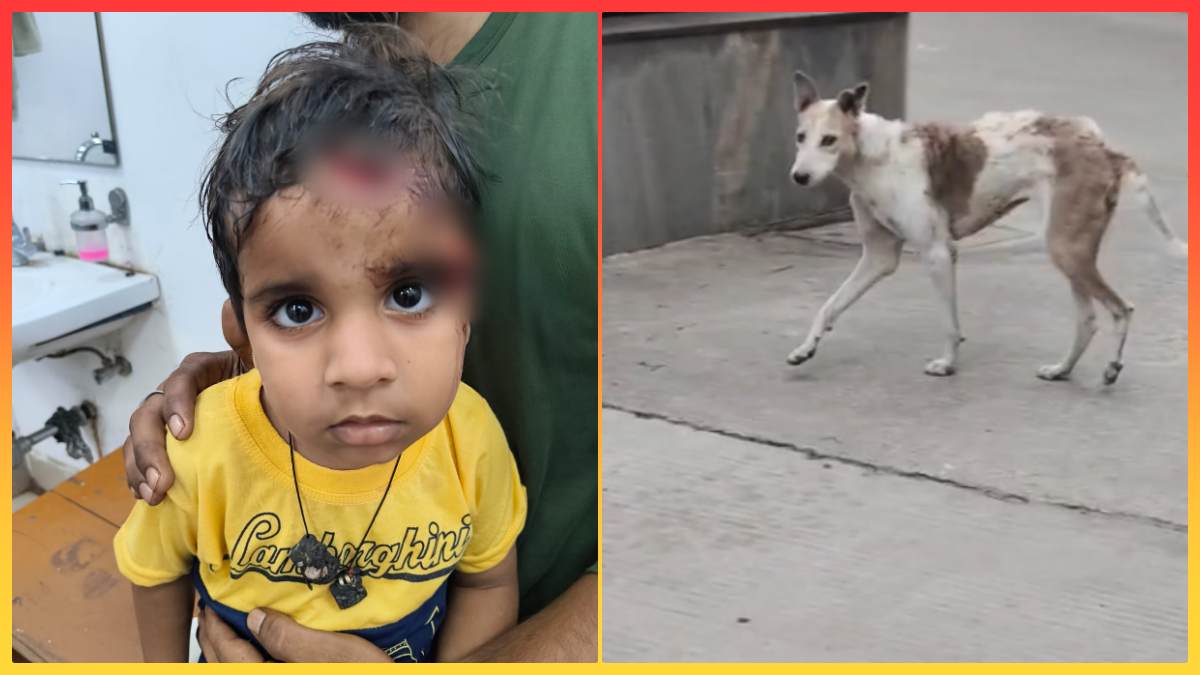 Gwalior Dog Bite: आवारा कुत्तों का आतंक, घर के बाहर खेल रहे साढ़े 3 साल के मासूम को नोंचा, माथे-सिर के पास आए टांके